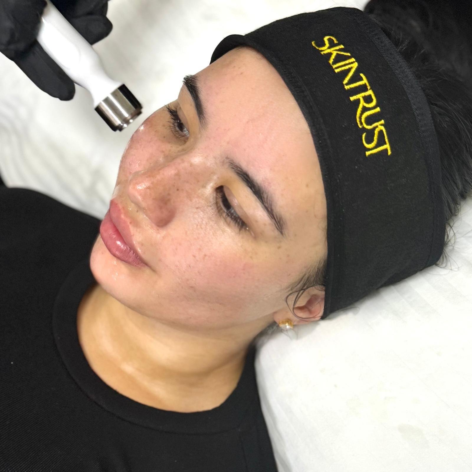 Hydrafacial